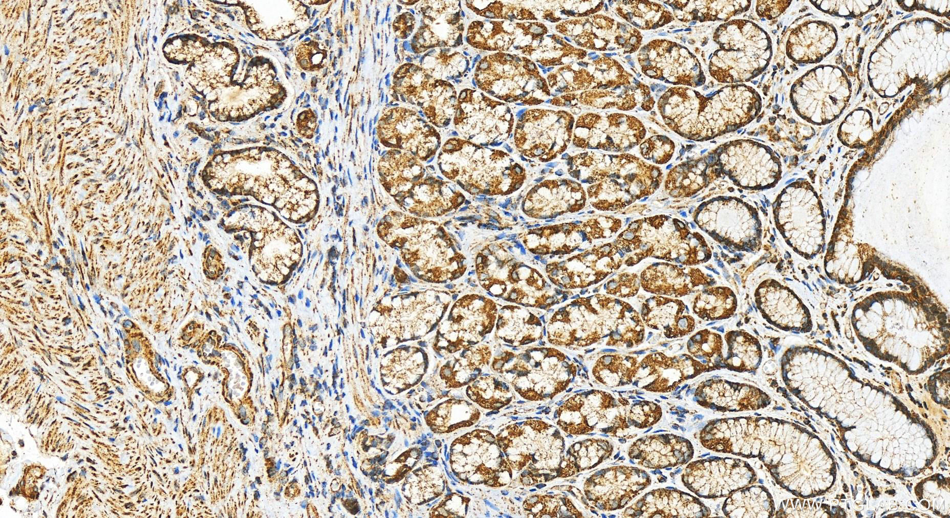 IHC staining of human stomach using 82508-1-RR