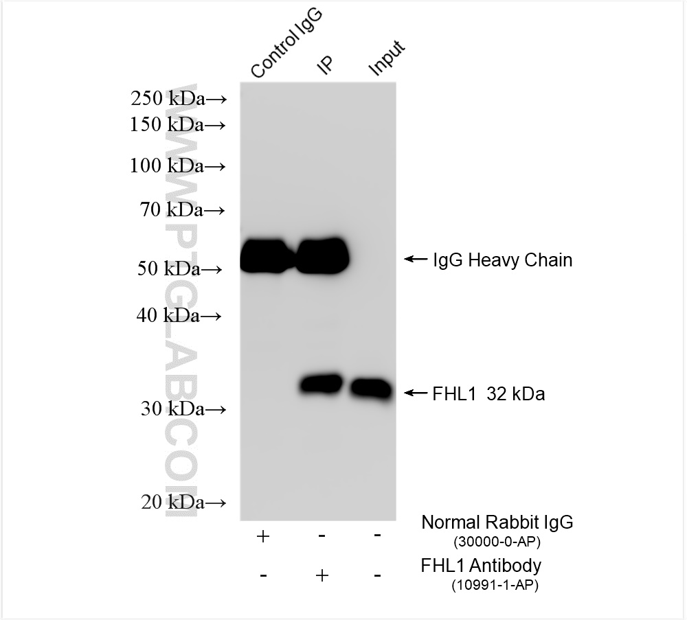 IP experiment of mouse skeletal muscle using 10991-1-AP