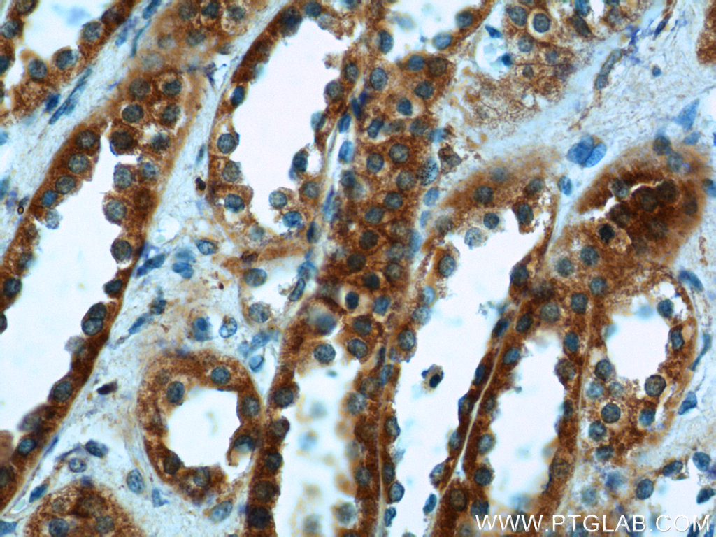 IHC staining of human kidney using 11974-1-AP