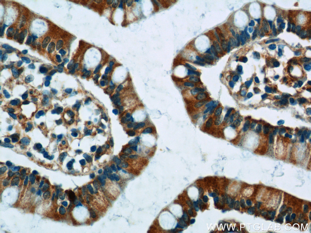 IHC staining of human small intestine using 11974-1-AP