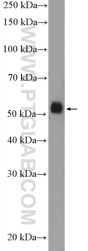 WB analysis of A549 using 11974-1-AP