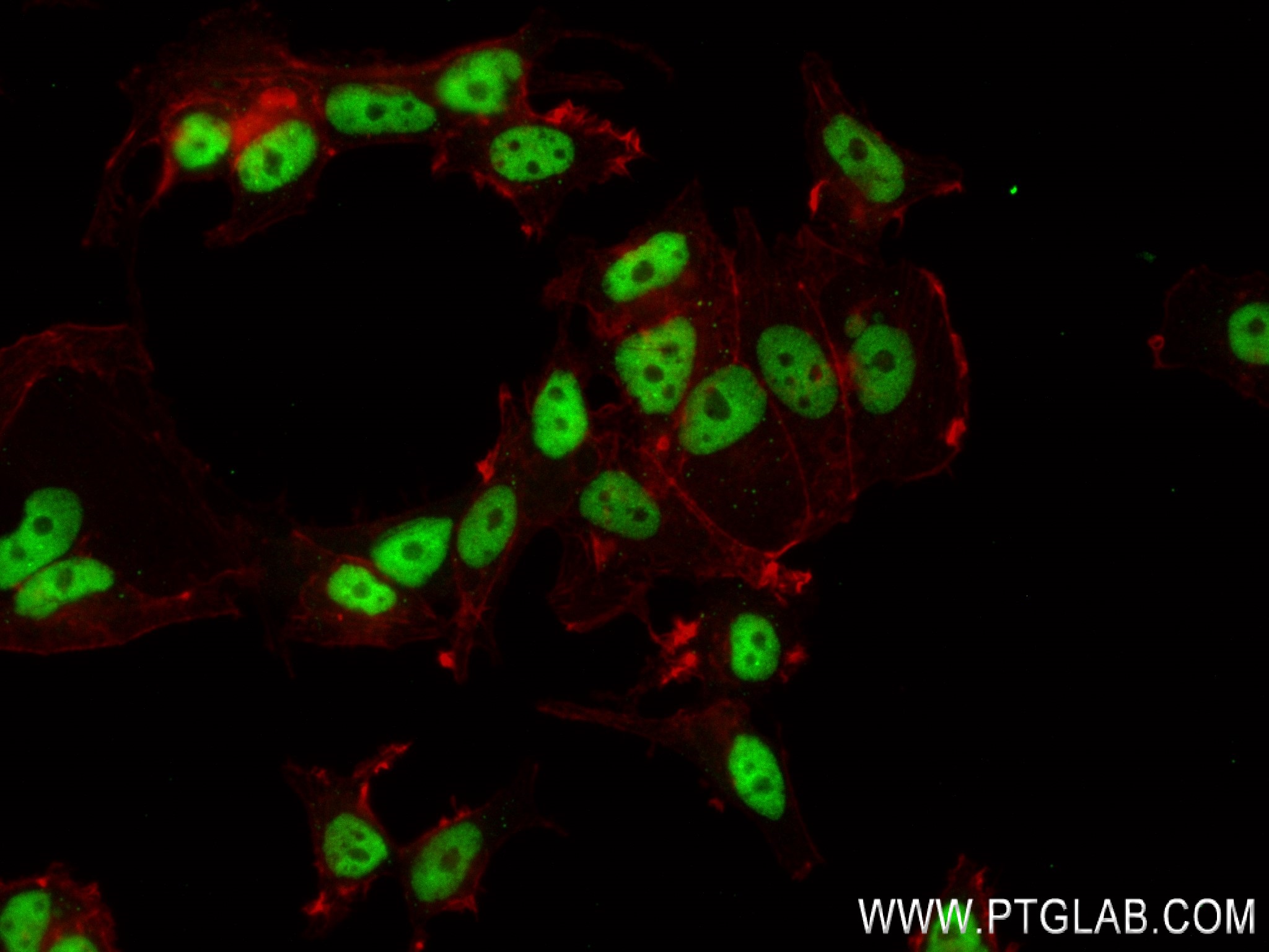 IF Staining of MCF-7 using 83863-3-RR