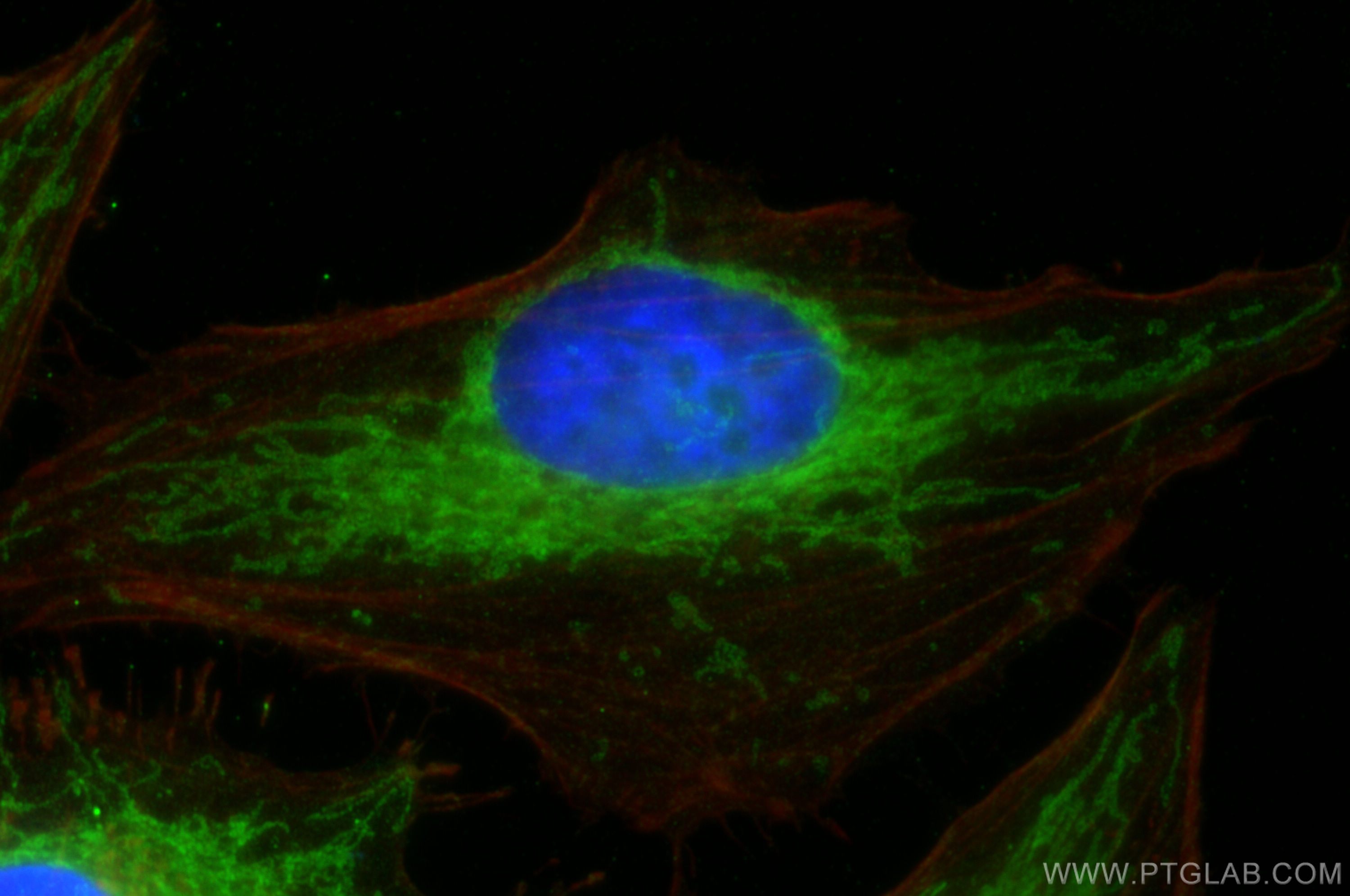 IF Staining of HeLa using 10956-1-AP