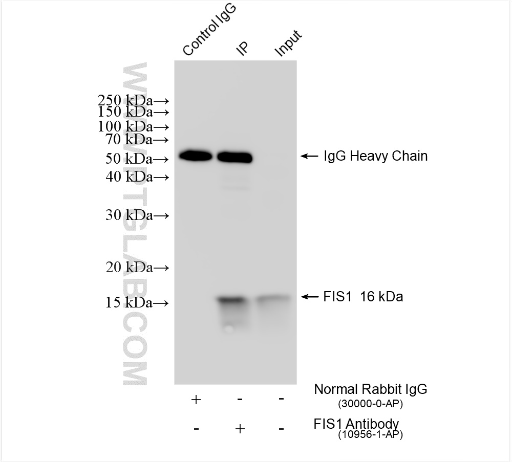 IP experiment of HeLa using 10956-1-AP