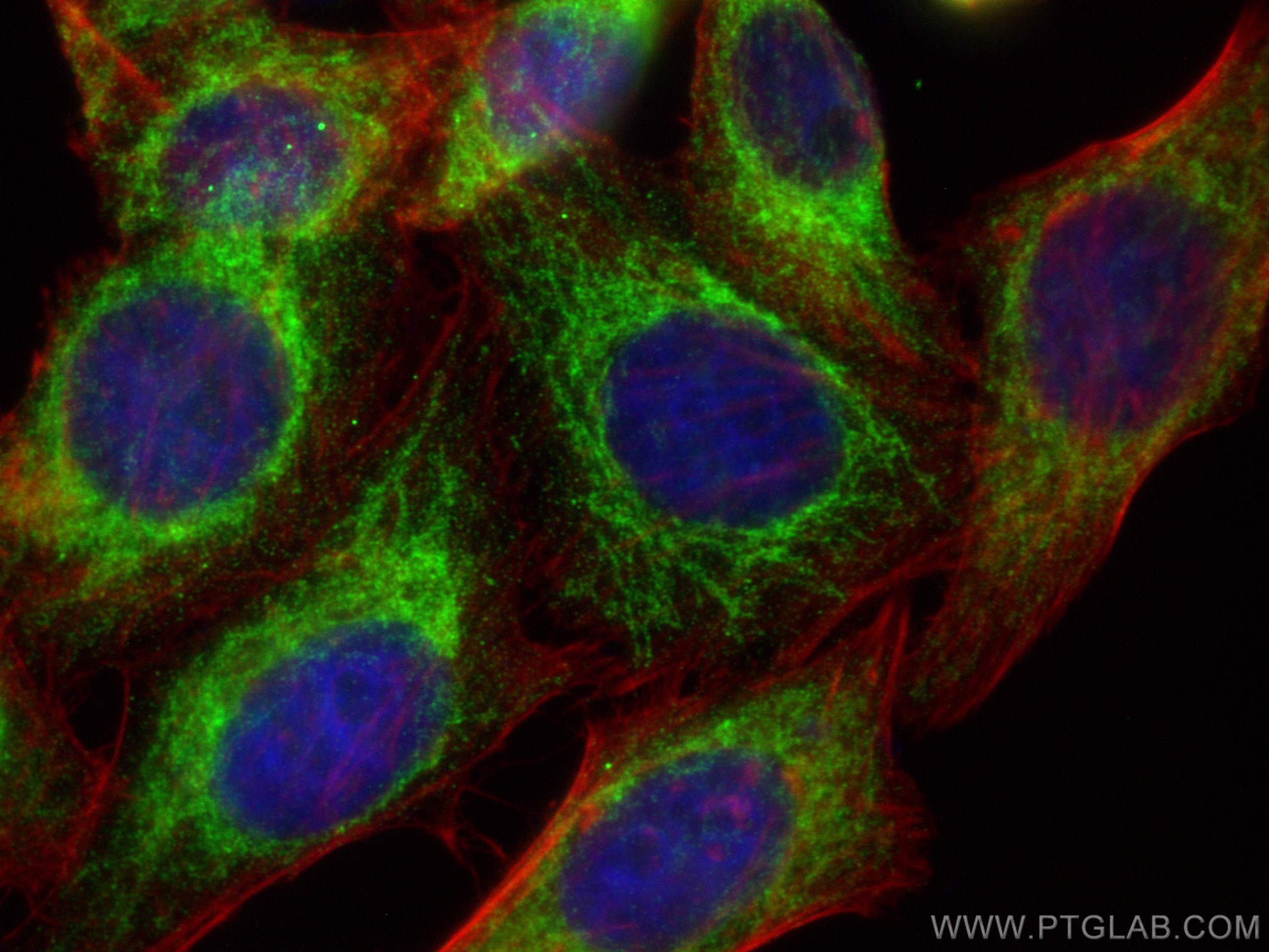 IF Staining of HepG2 using 66635-1-Ig (same clone as 66635-1-PBS)