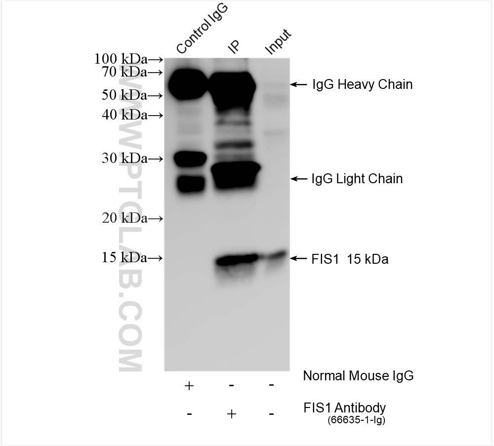 IP experiment of HeLa using 66635-1-Ig