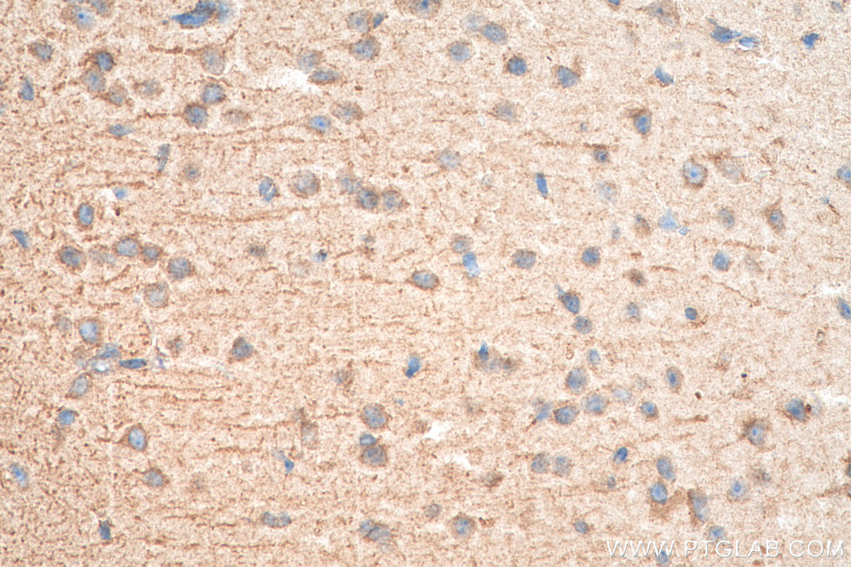 IHC staining of mouse brain using 17417-1-AP