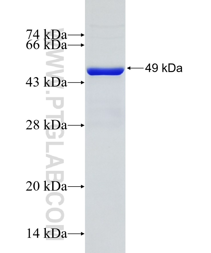 FJX1 fusion protein Ag29289 SDS-PAGE