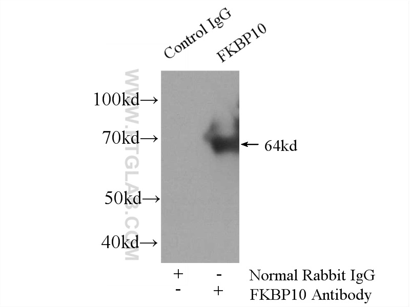 IP experiment of HEK-293 using 12172-1-AP