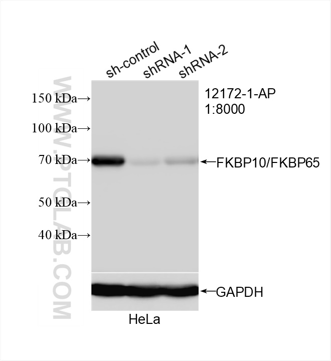 WB analysis of HeLa using 12172-1-AP