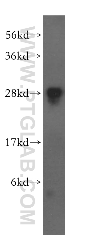 WB analysis of HEK-293 using 15884-1-AP