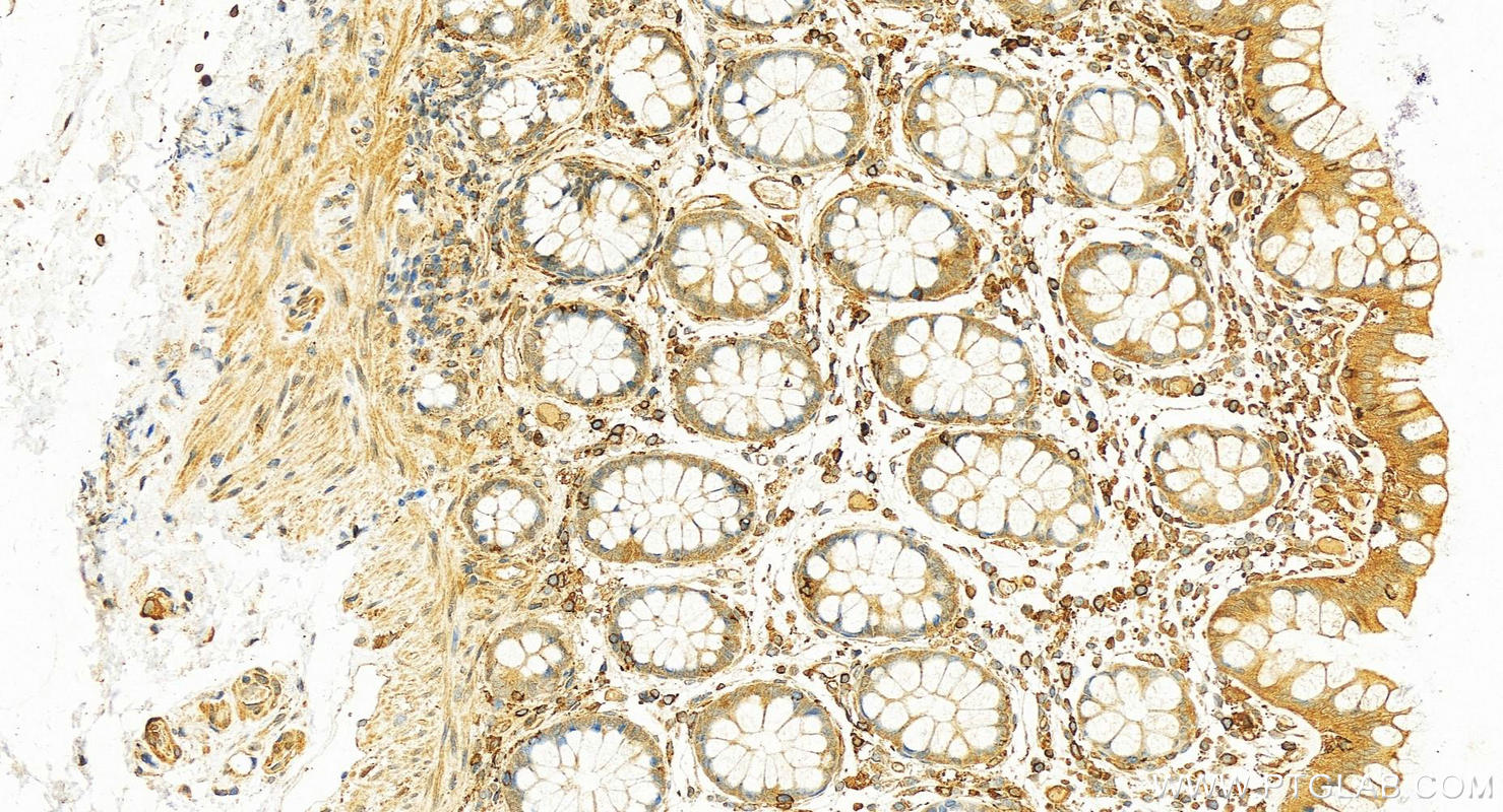 IHC staining of human normal colon using 10273-1-AP