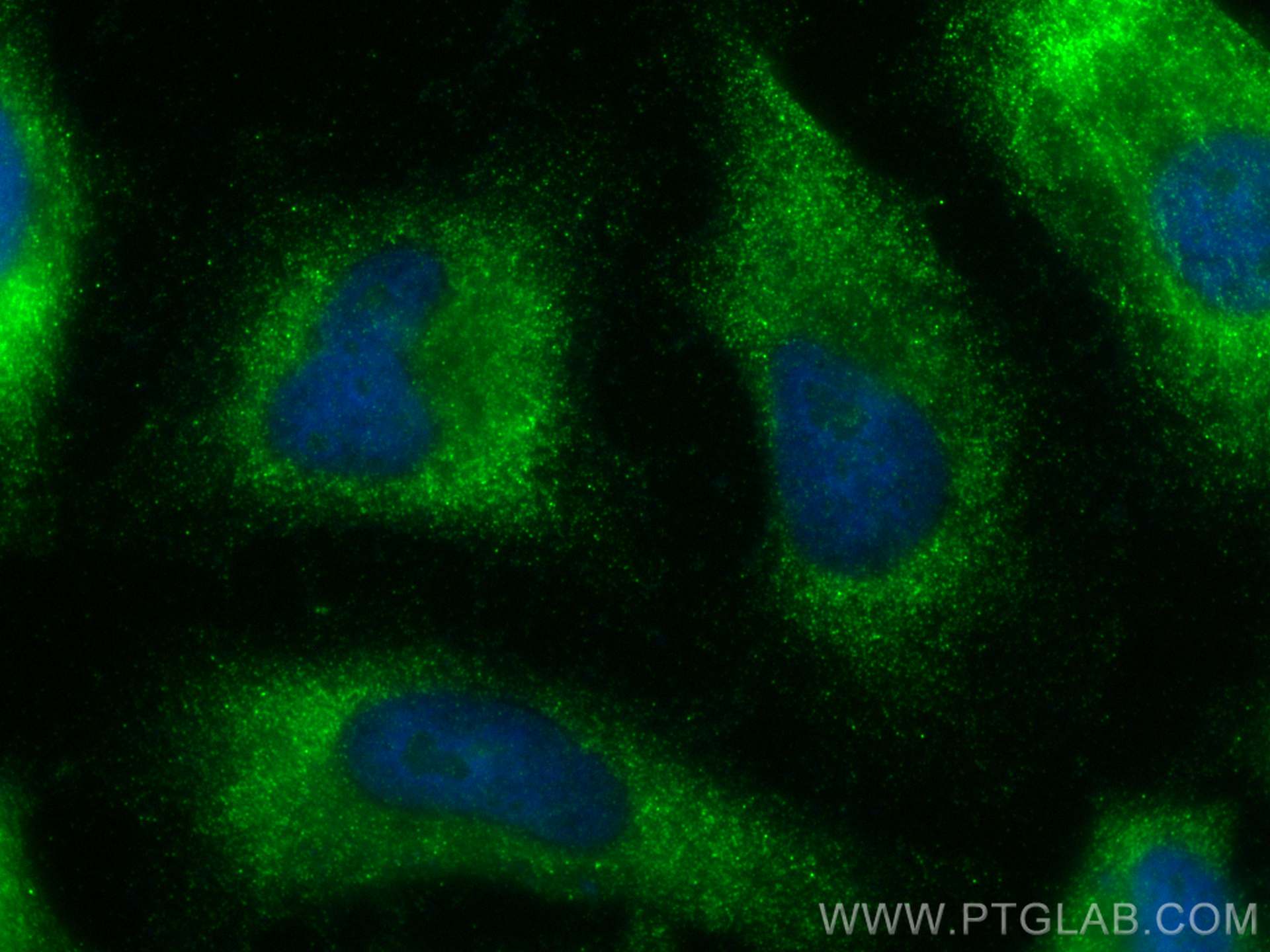 IF Staining of HeLa using 11755-1-AP