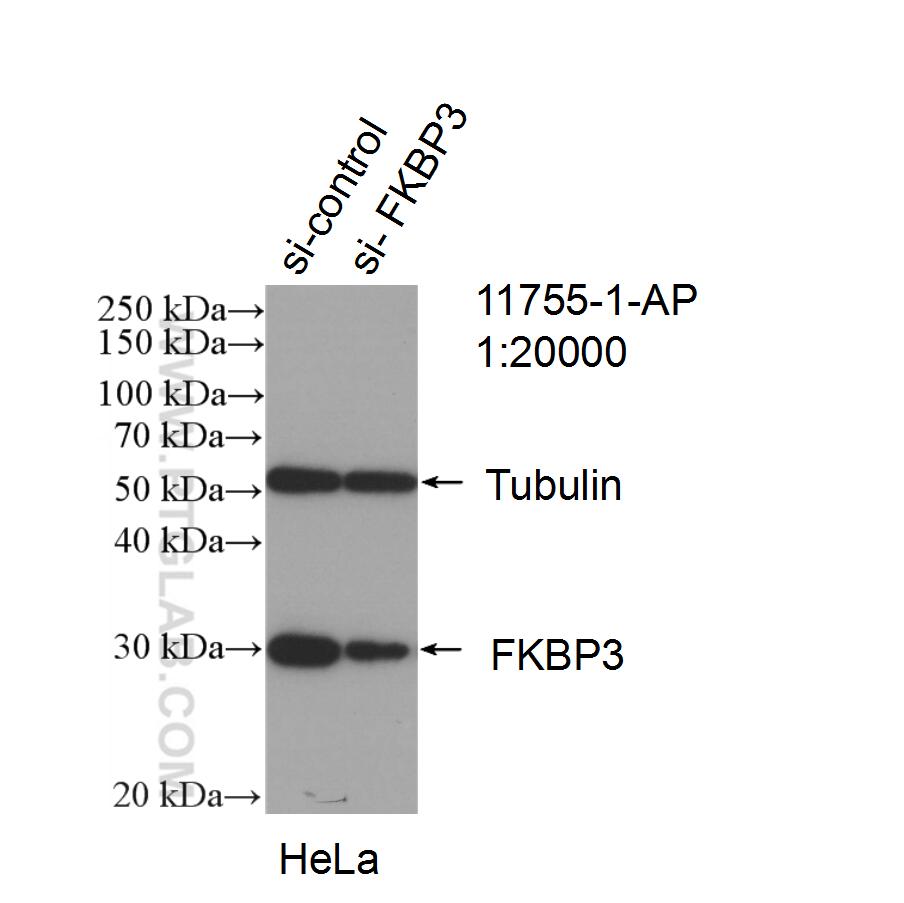 WB analysis of HeLa using 11755-1-AP