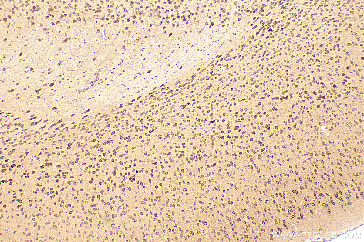 IHC staining of mouse brain using 14155-1-AP