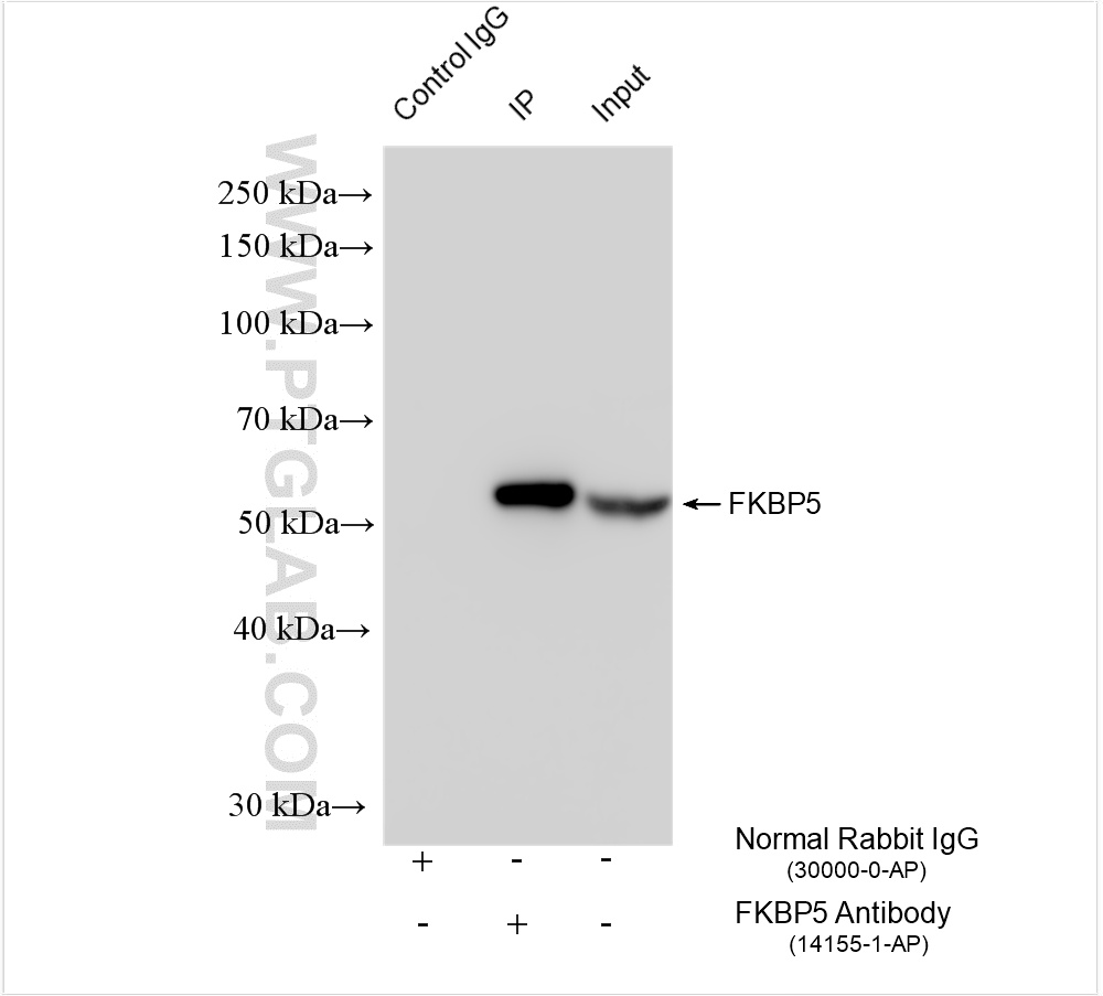 IP experiment of K-562 using 14155-1-AP