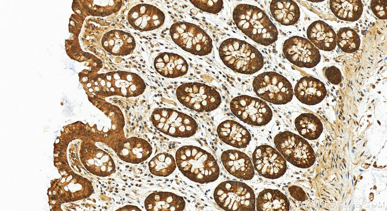 IHC staining of human colon using 22623-1-AP