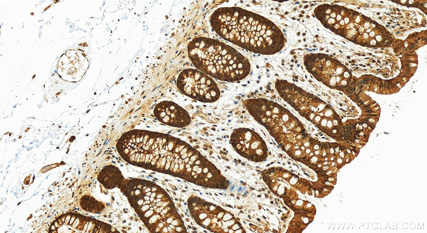 IHC staining of human colon using 22623-1-AP