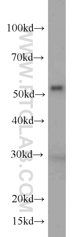 WB analysis of HeLa using 66040-1-Ig