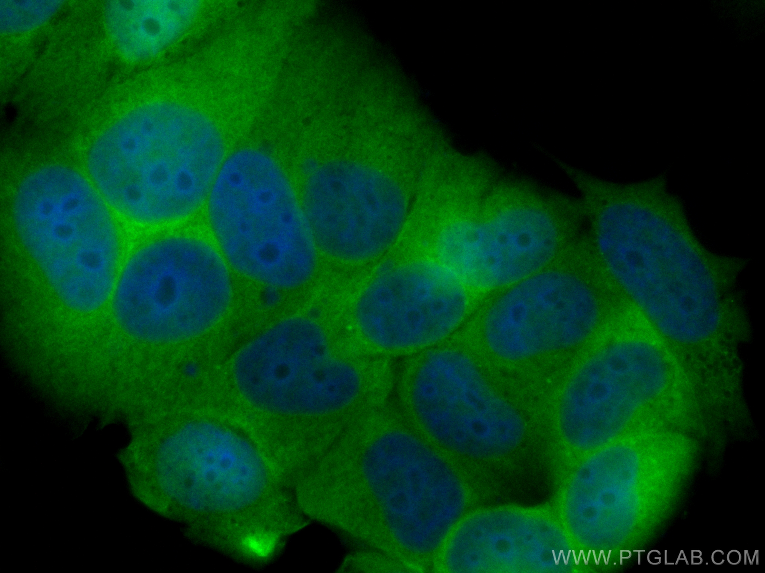 IF Staining of MCF-7 using CL488-10655