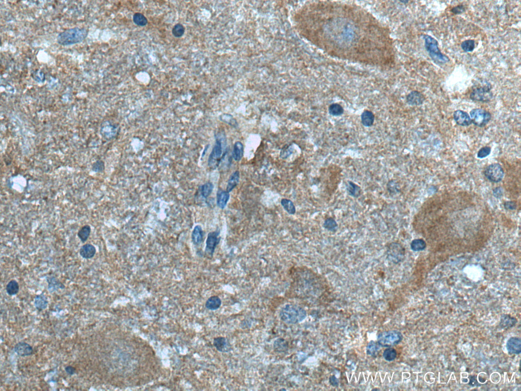 IHC staining of human hypothalamus using 66690-1-Ig