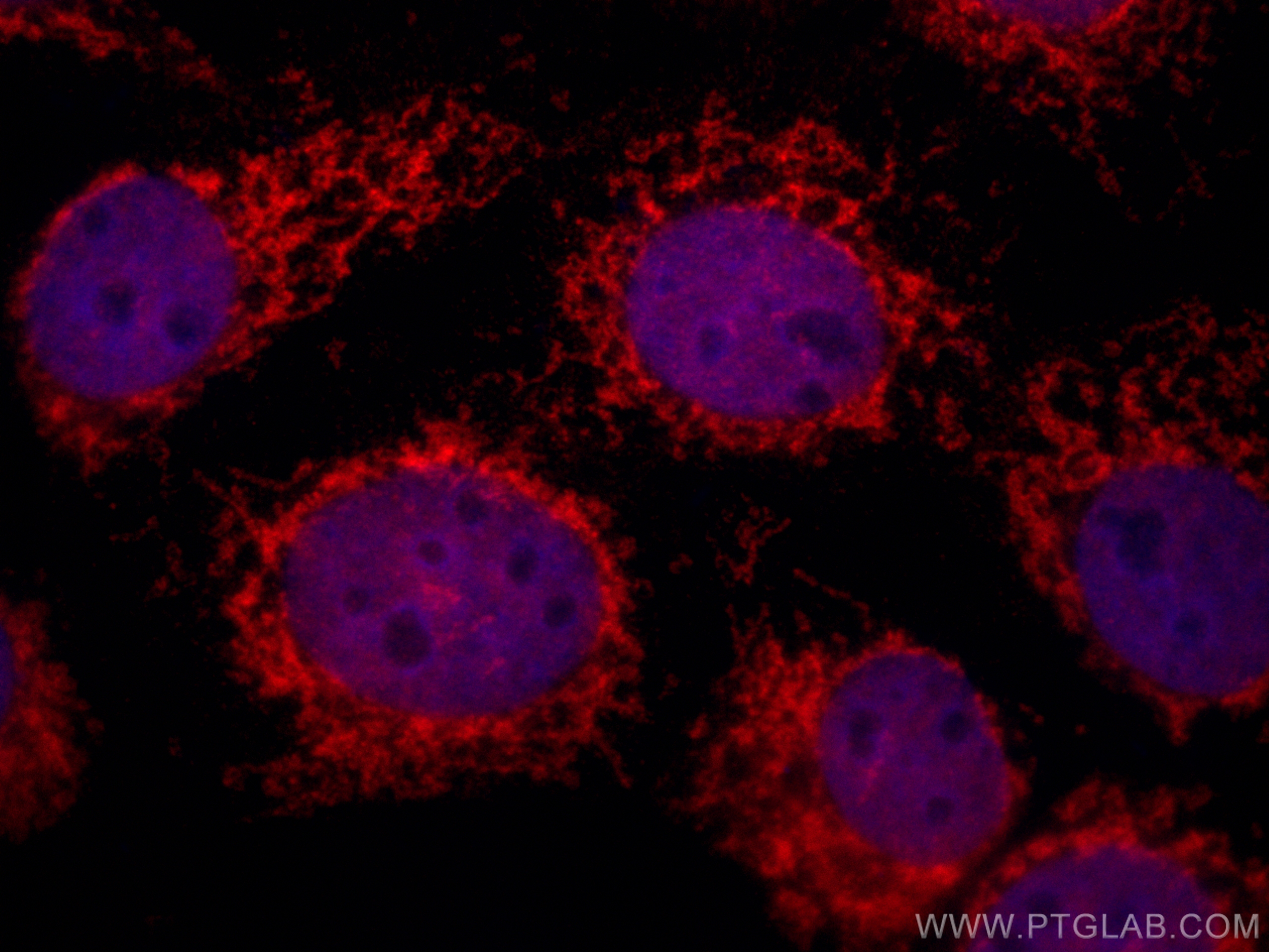 IF Staining of A431 using CL594-66690