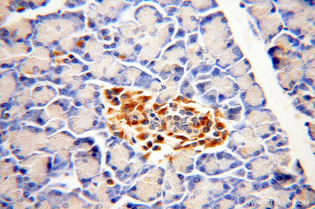 IHC staining of human pancreas using 18276-1-AP