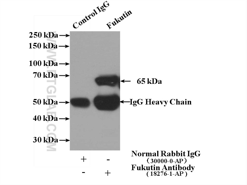 IP experiment of mouse brain using 18276-1-AP