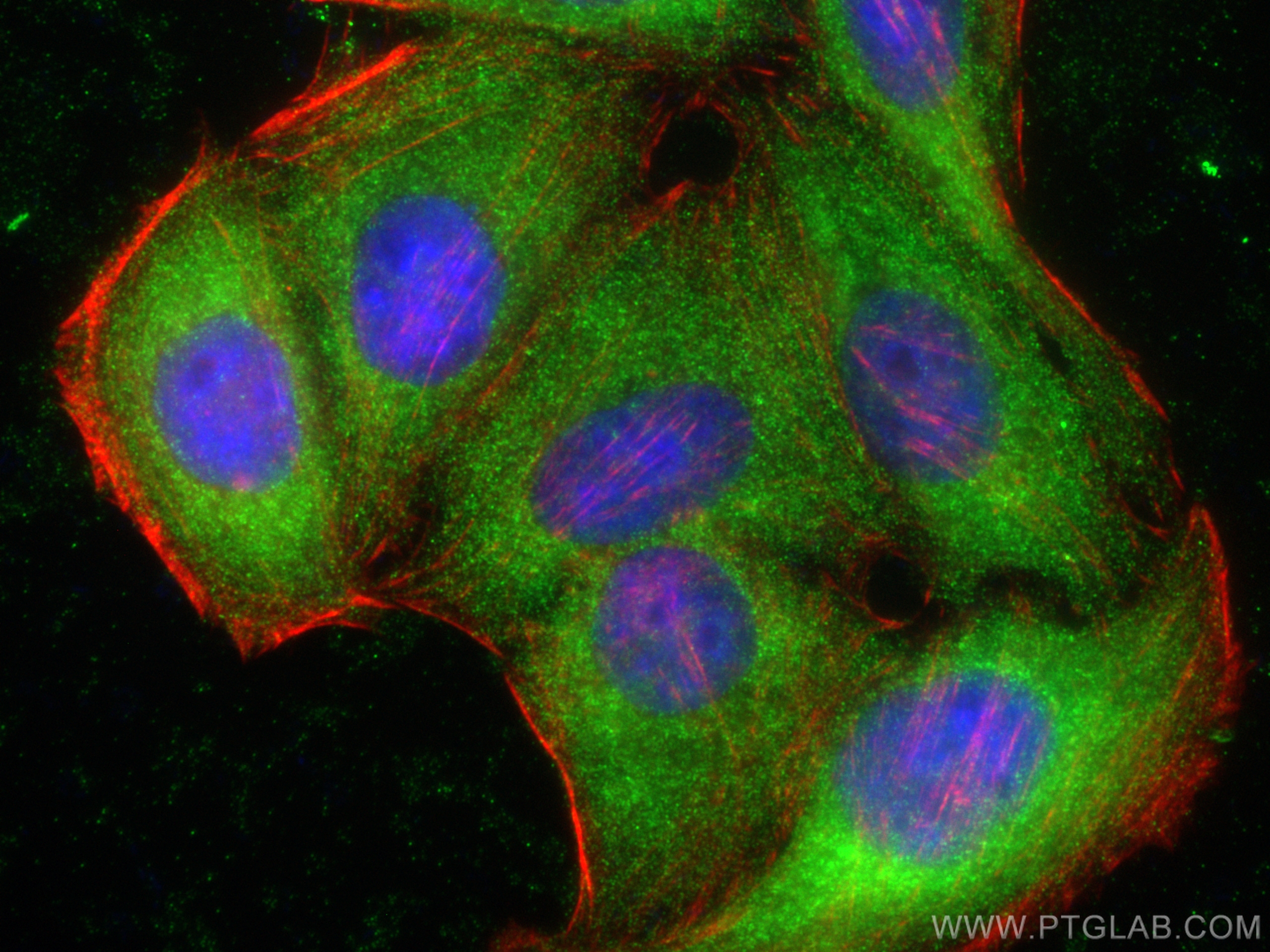 IF Staining of HepG2 using 14118-1-AP