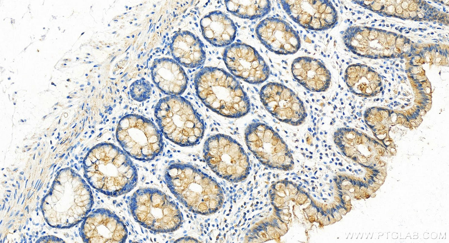 IHC staining of human colon using 20685-1-AP