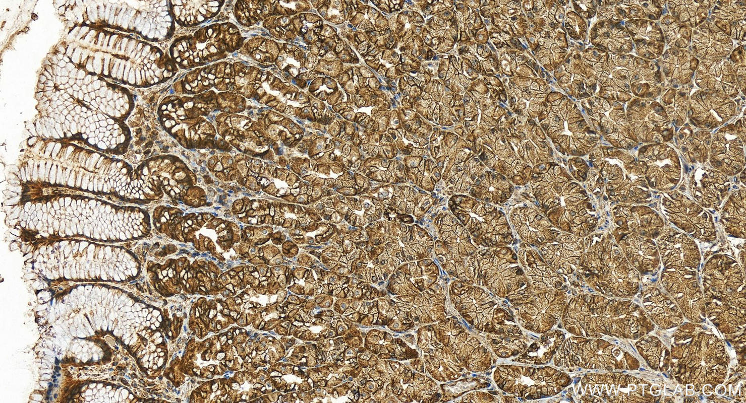 IHC staining of human stomach using 15571-1-AP