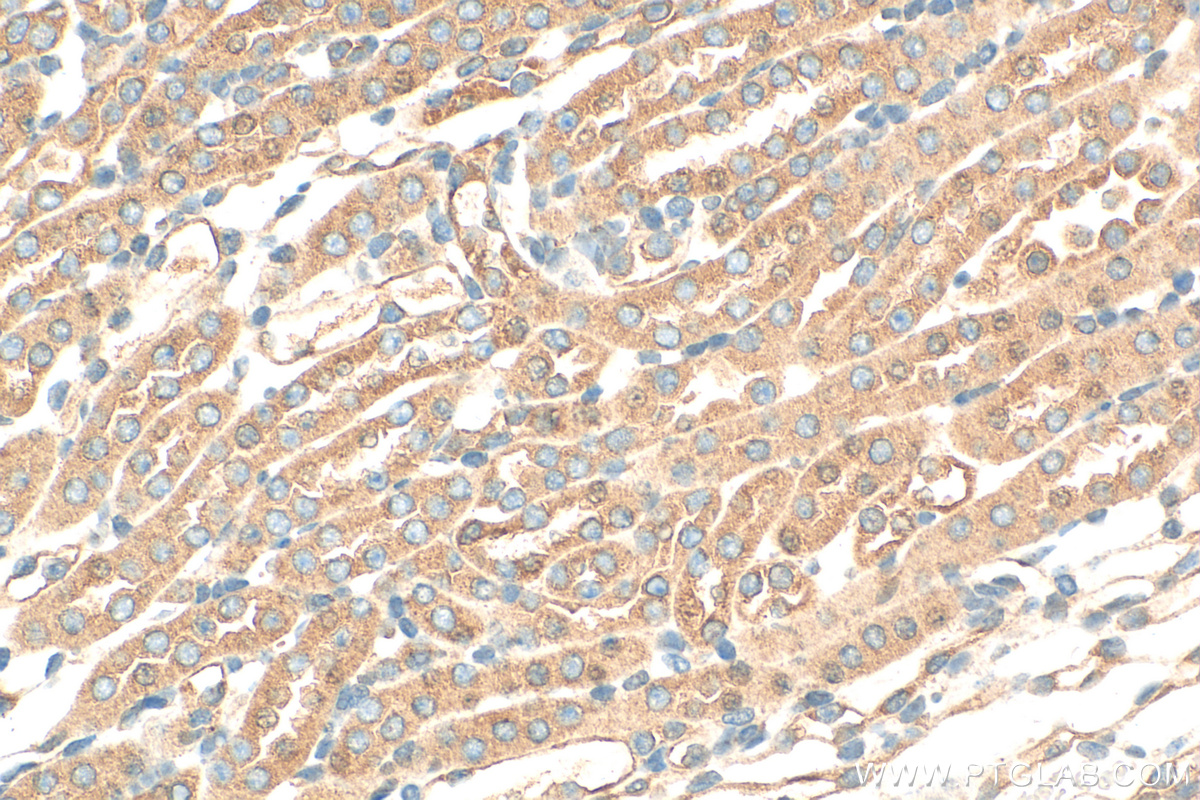 IHC staining of mouse kidney using 26841-1-AP