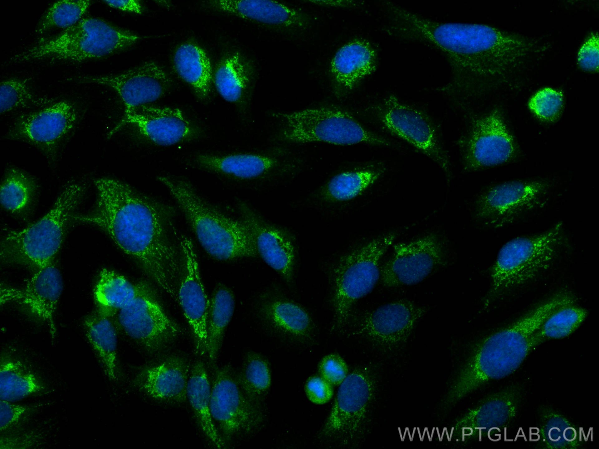 IF Staining of U2OS using 10395-1-AP