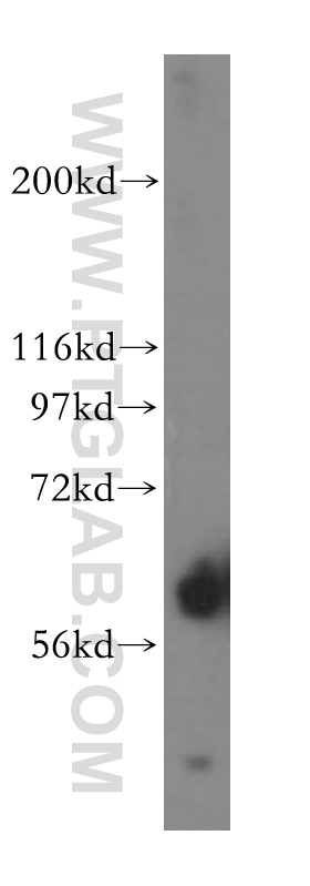 WB analysis of human liver using 13699-1-AP