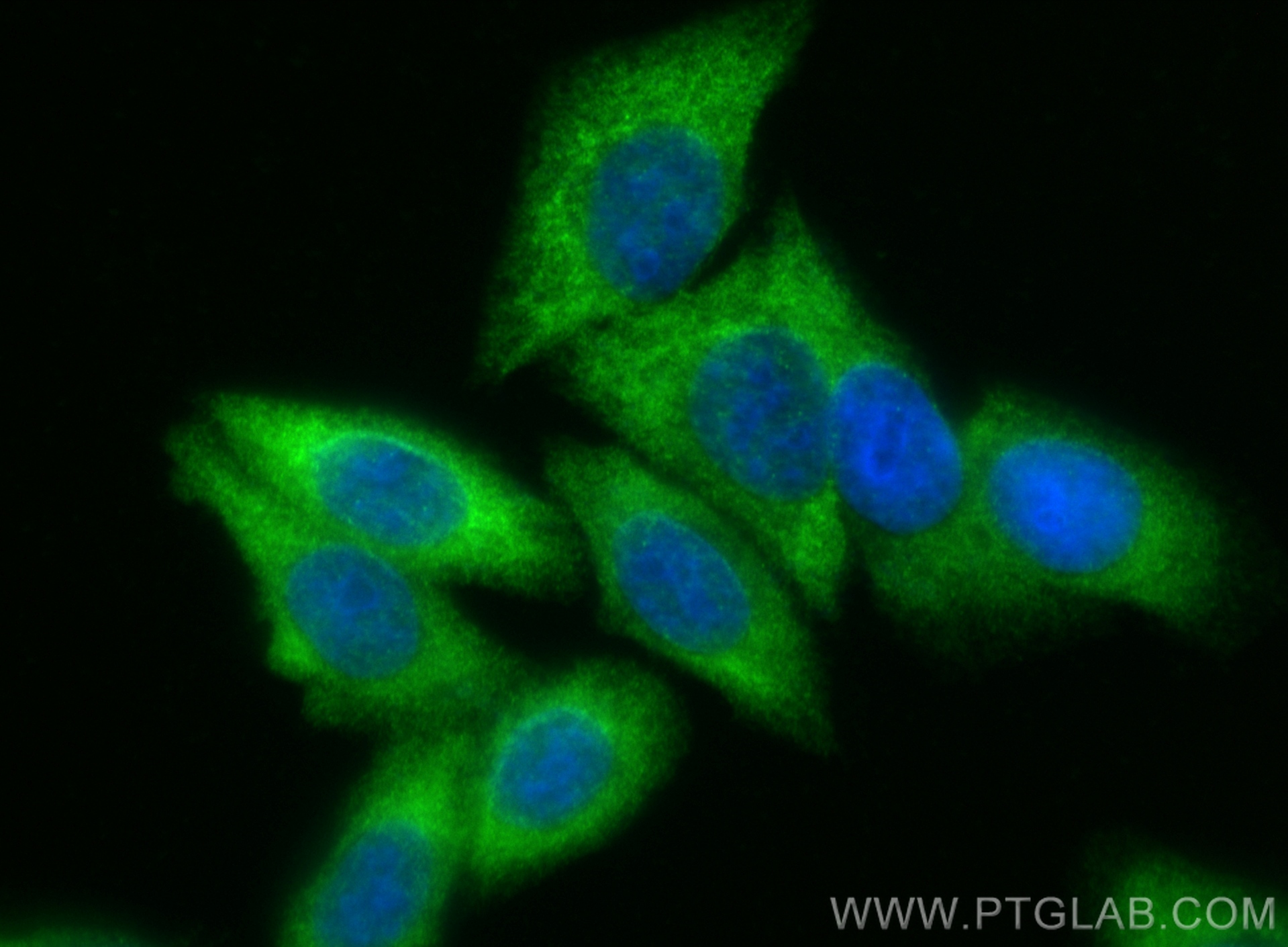 IF Staining of HepG2 using 13281-1-AP