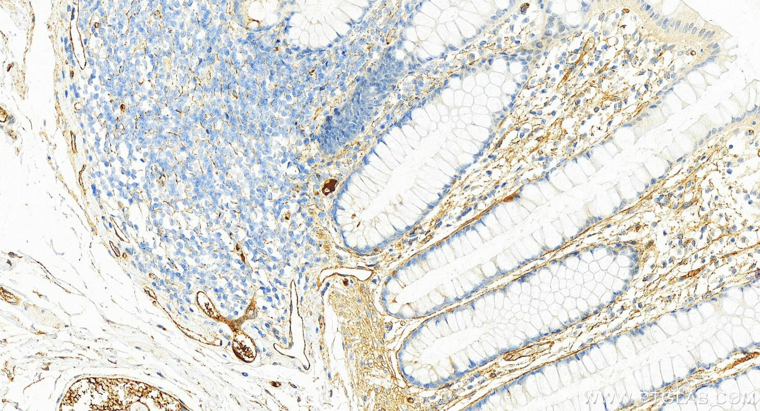 IHC staining of human colon using 15613-1-AP