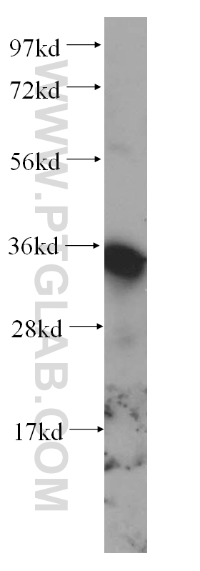 WB analysis of HeLa using 14293-1-AP