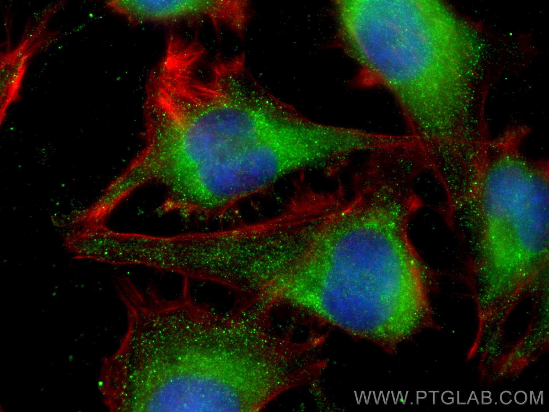 IF Staining of U-251 using 25240-1-AP