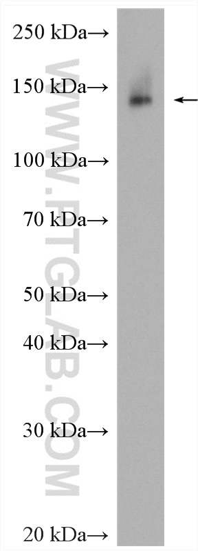 WB analysis of 4T1 using 22605-1-AP