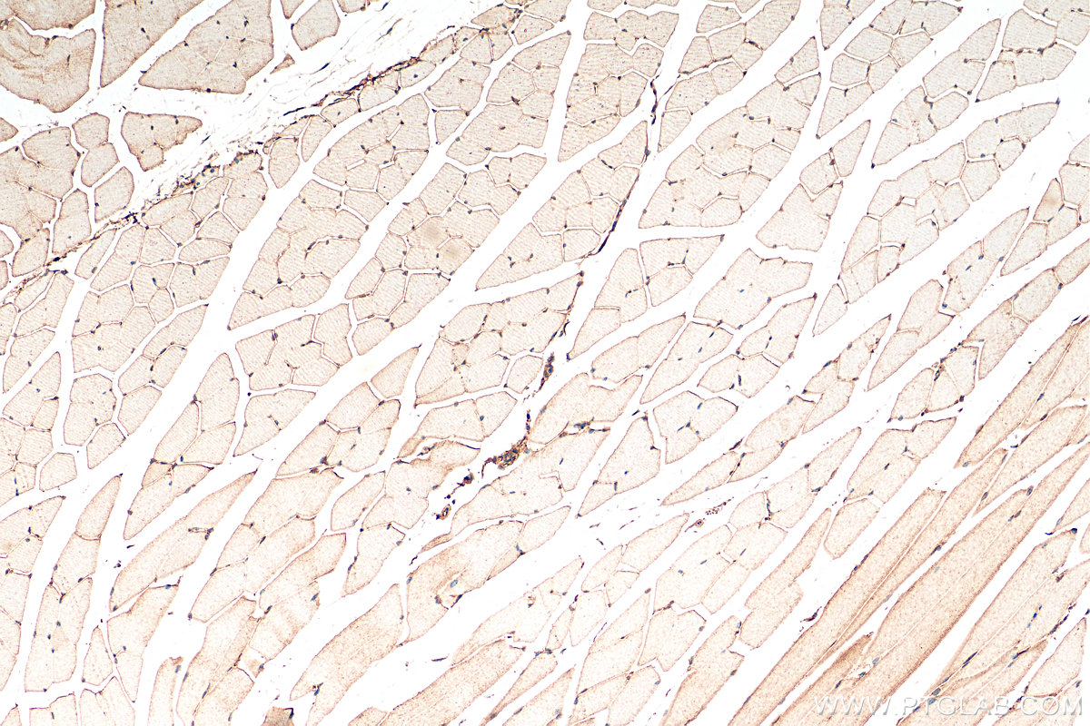 IHC staining of mouse skeletal muscle using 82671-1-RR (same clone as 82671-1-PBS)