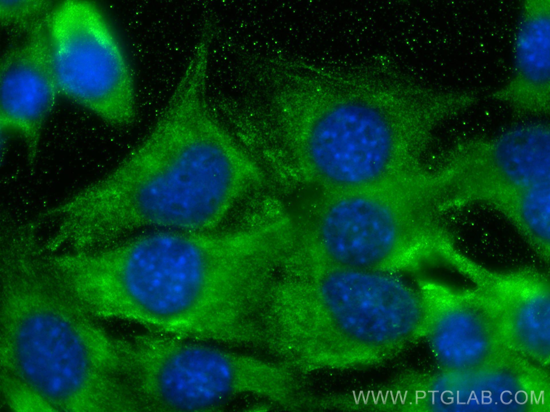 IF Staining of C2C12 using 28380-1-AP