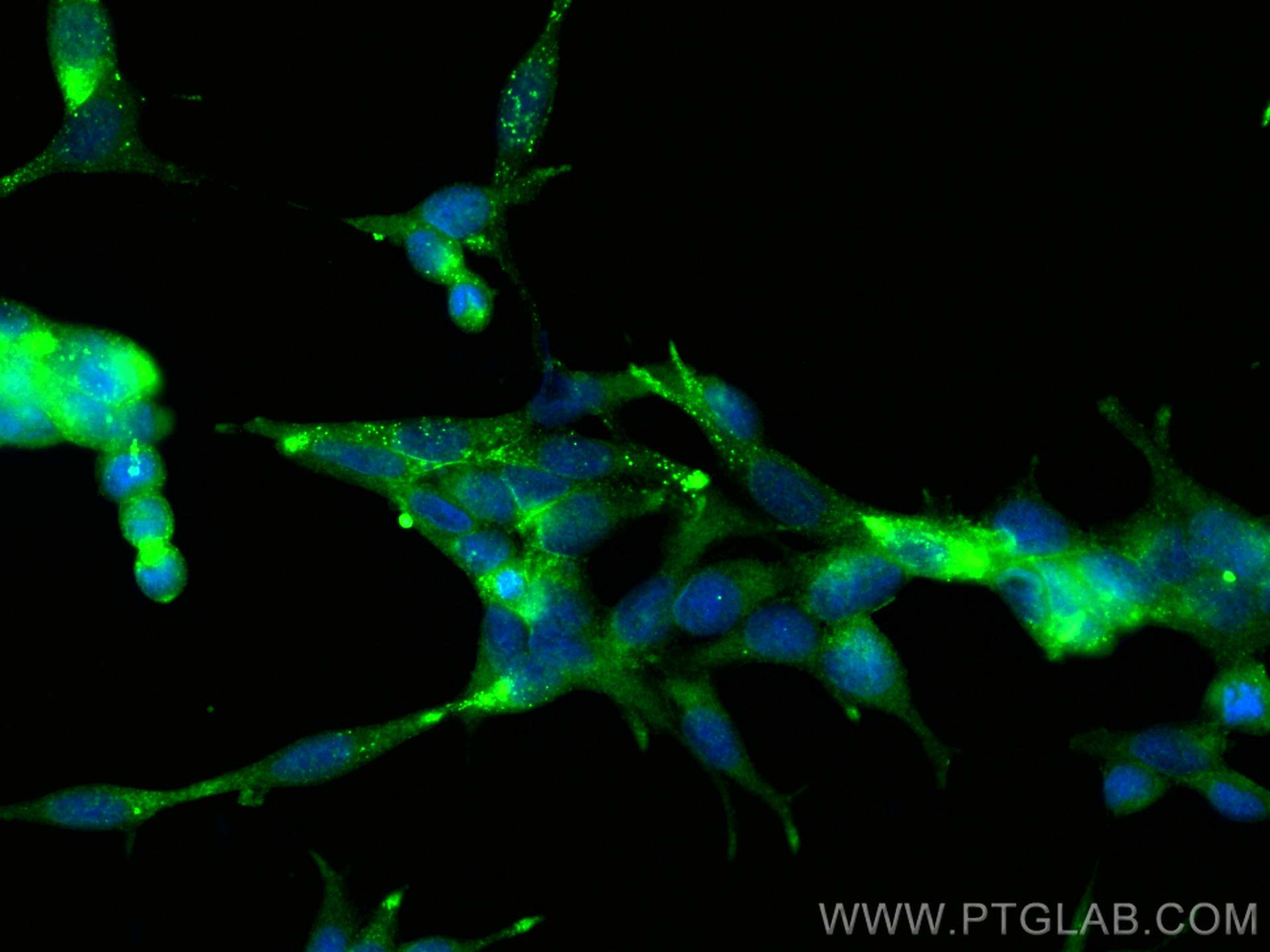 IF Staining of LNCaP using 13163-1-AP