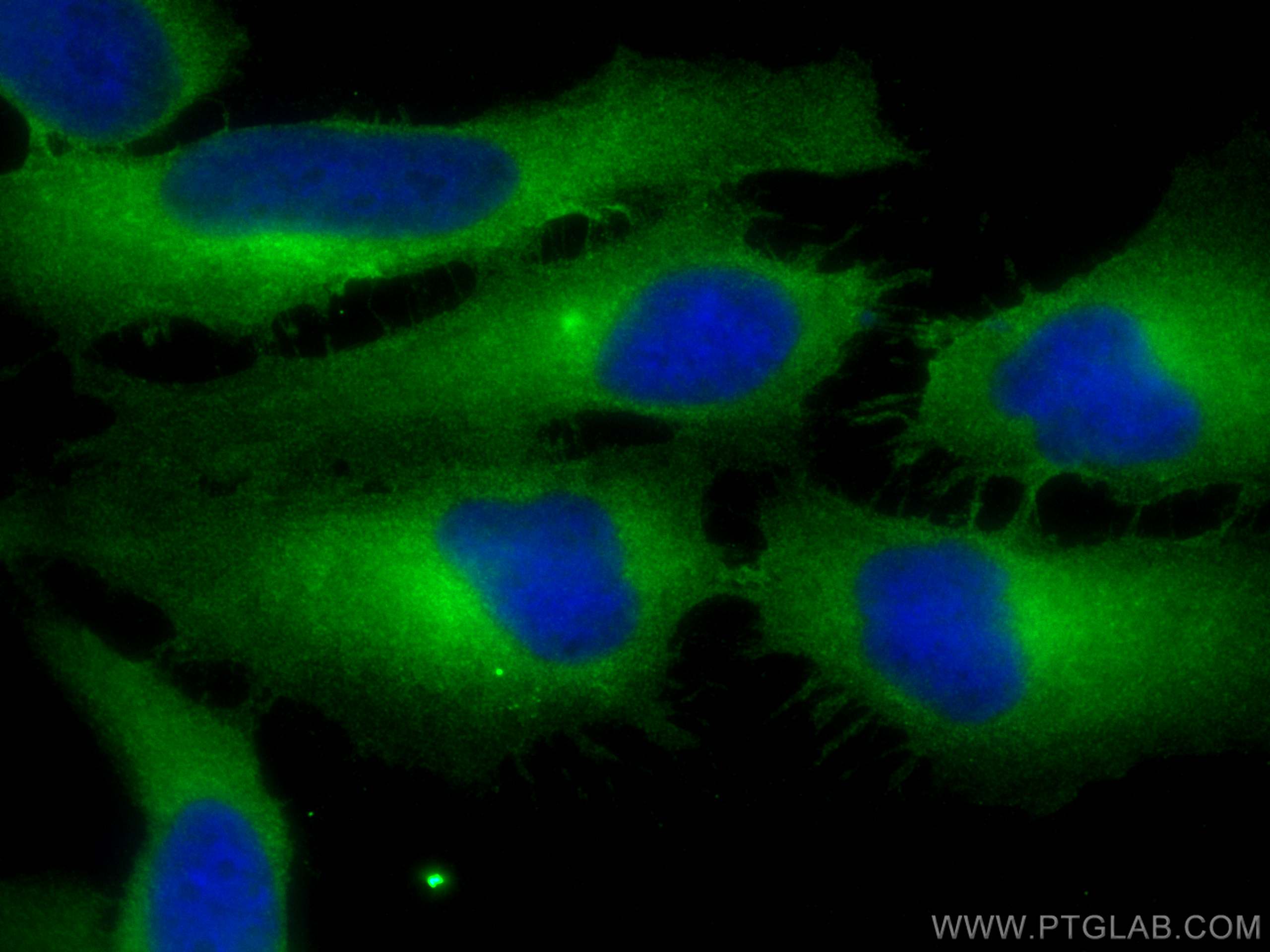 IF Staining of HeLa using 23355-1-AP