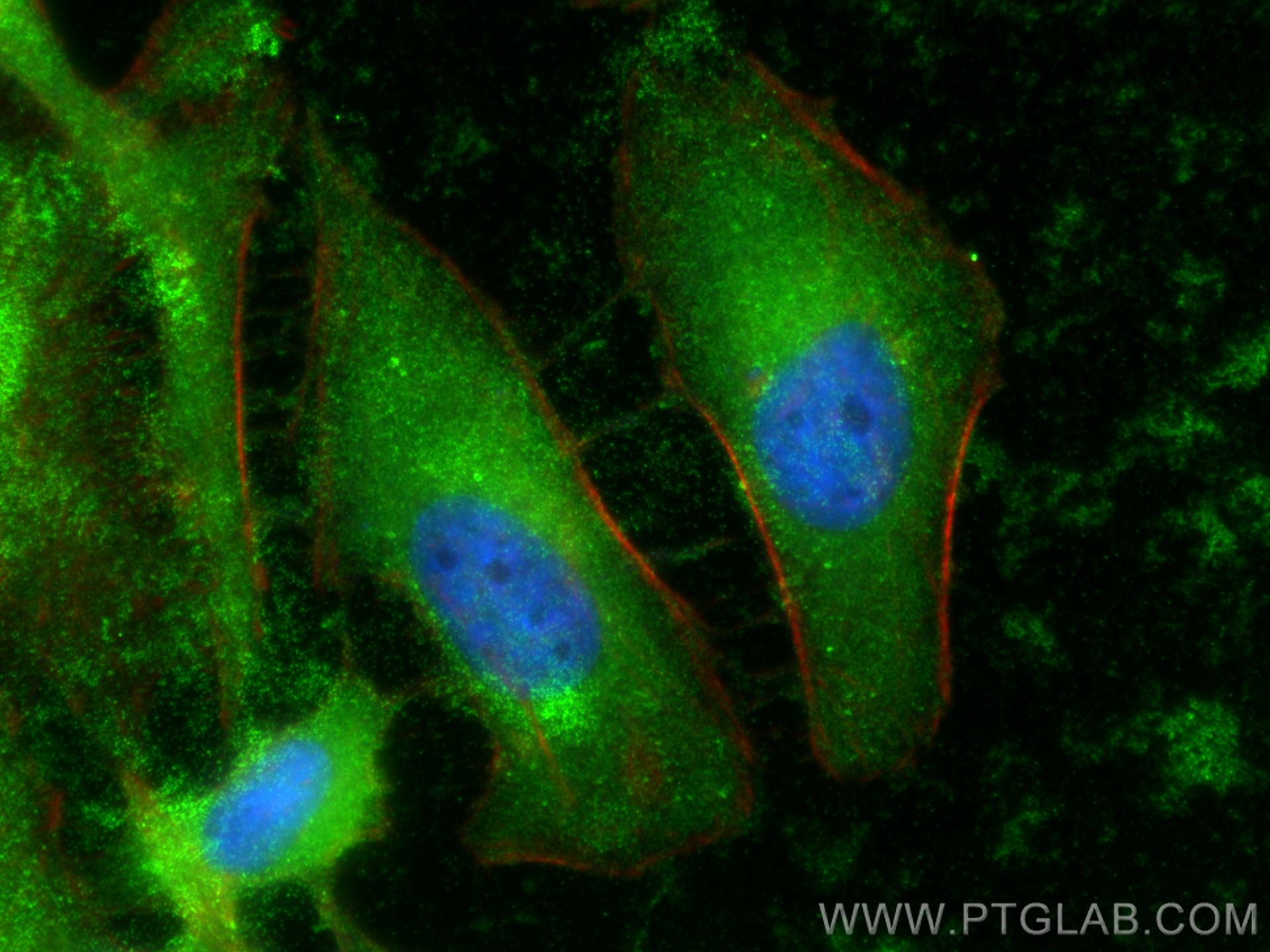 IF Staining of HeLa using 31264-1-AP