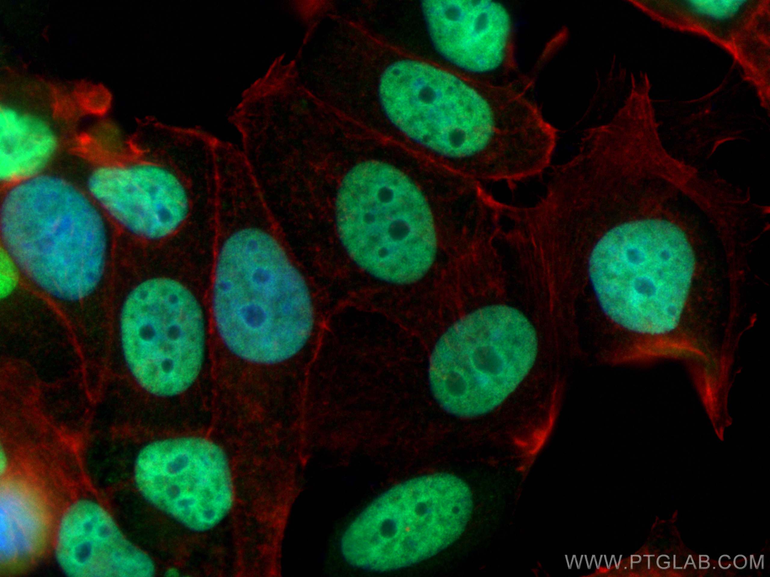 IF Staining of MCF-7 using 20411-1-AP