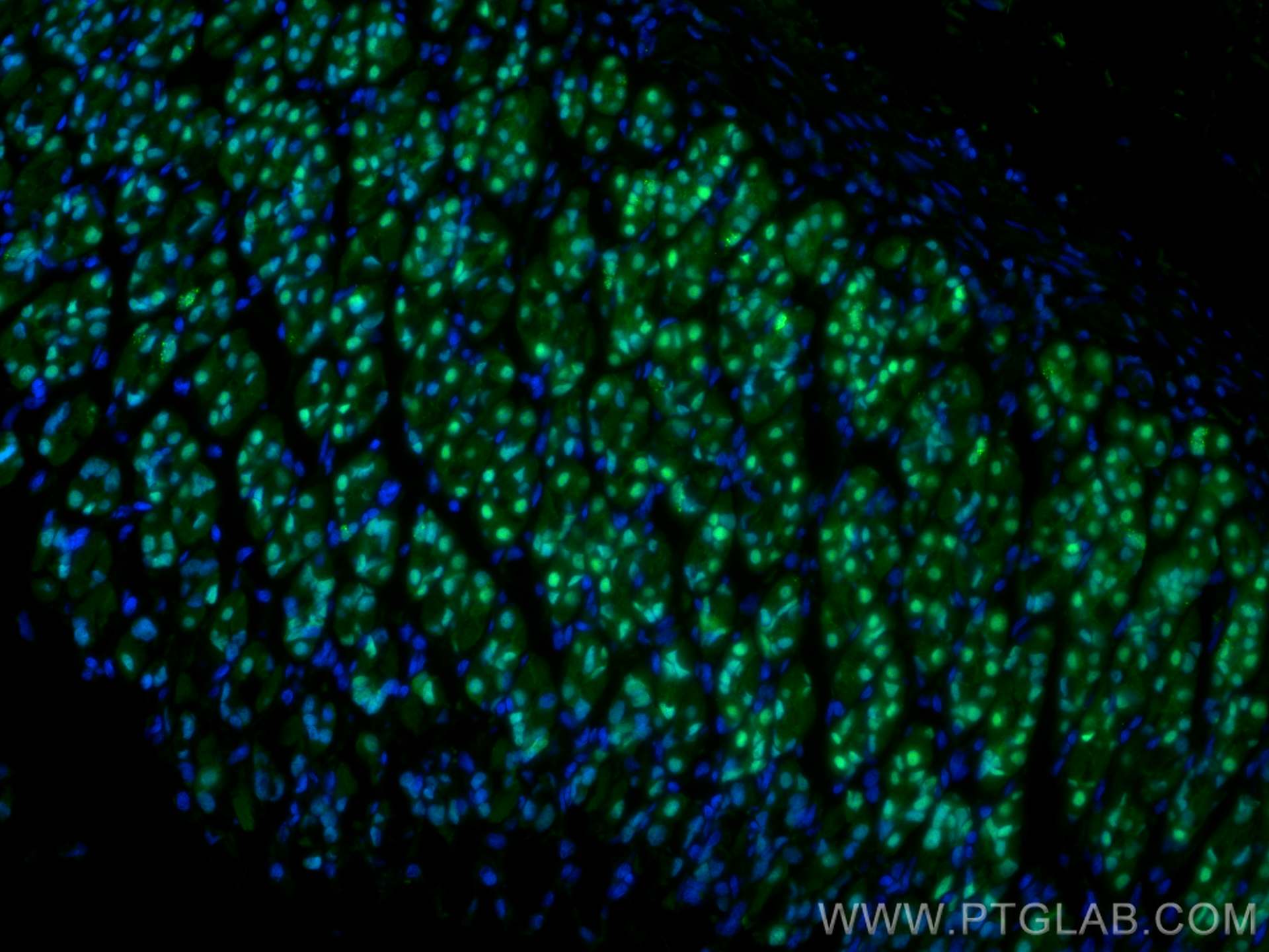 IF Staining of rat stomach using 22474-1-AP