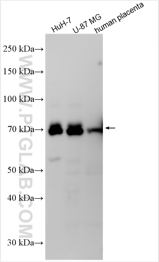 WB analysis using 28301-1-AP