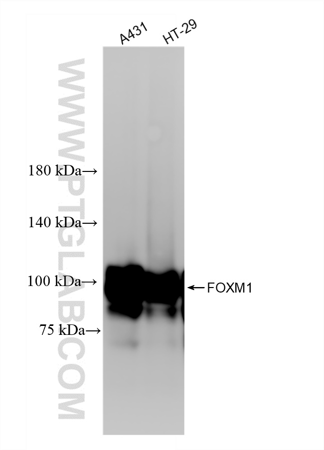 FOXM1