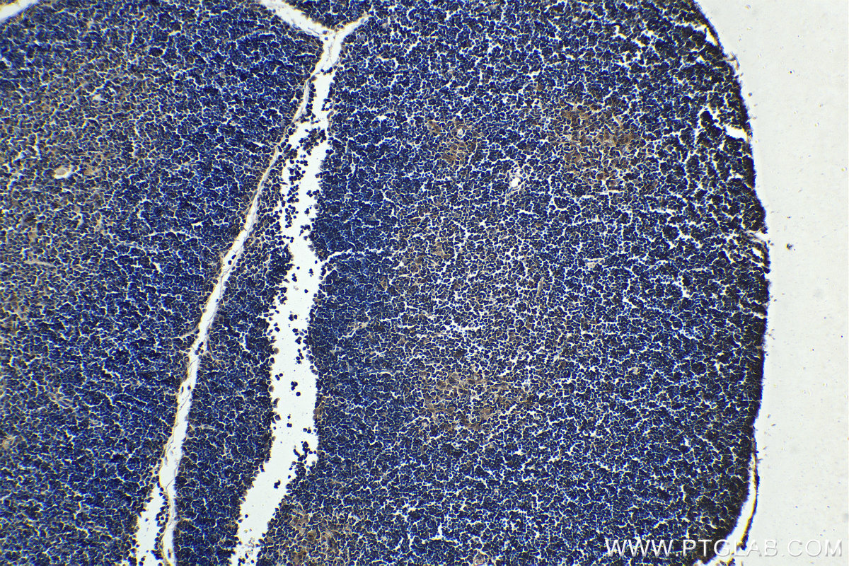 IHC staining of mouse thymus using 66337-1-Ig