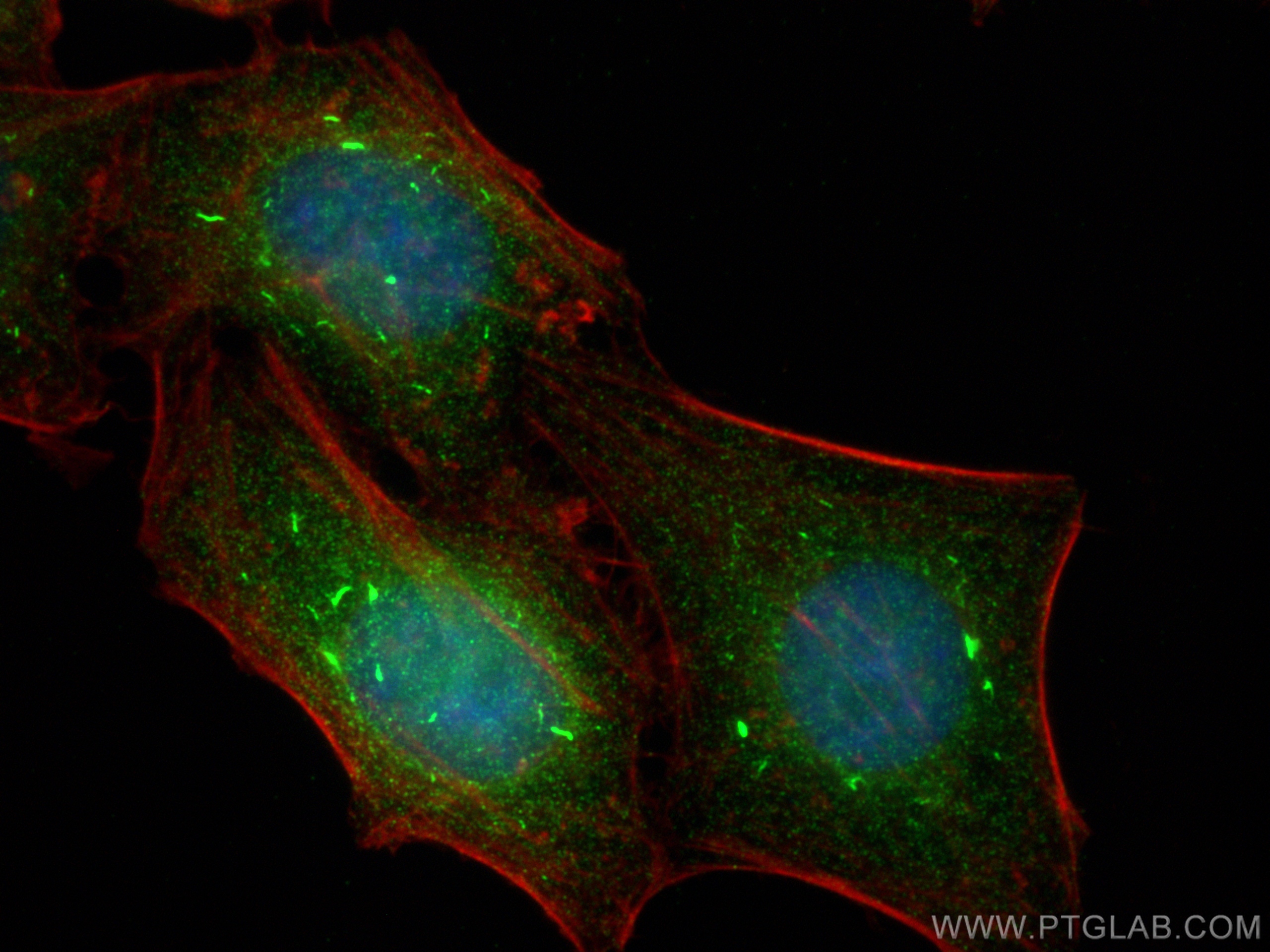 IF Staining of HepG2 using 82997-1-RR (same clone as 82997-1-PBS)